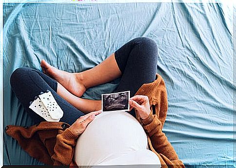 Pregnant woman watching an ultrasound